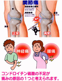 腰痛・関節痛でお悩みの方に!