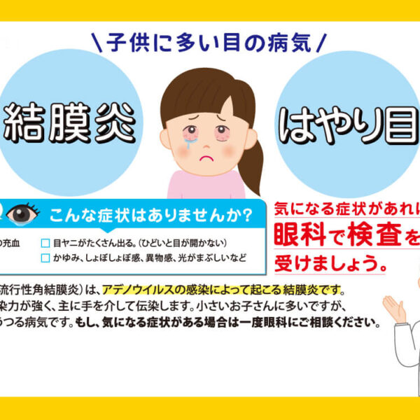 【サクラマチ眼科】結膜炎・はやり目